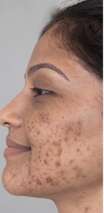 Facial pigmentation at an earlier stage of care